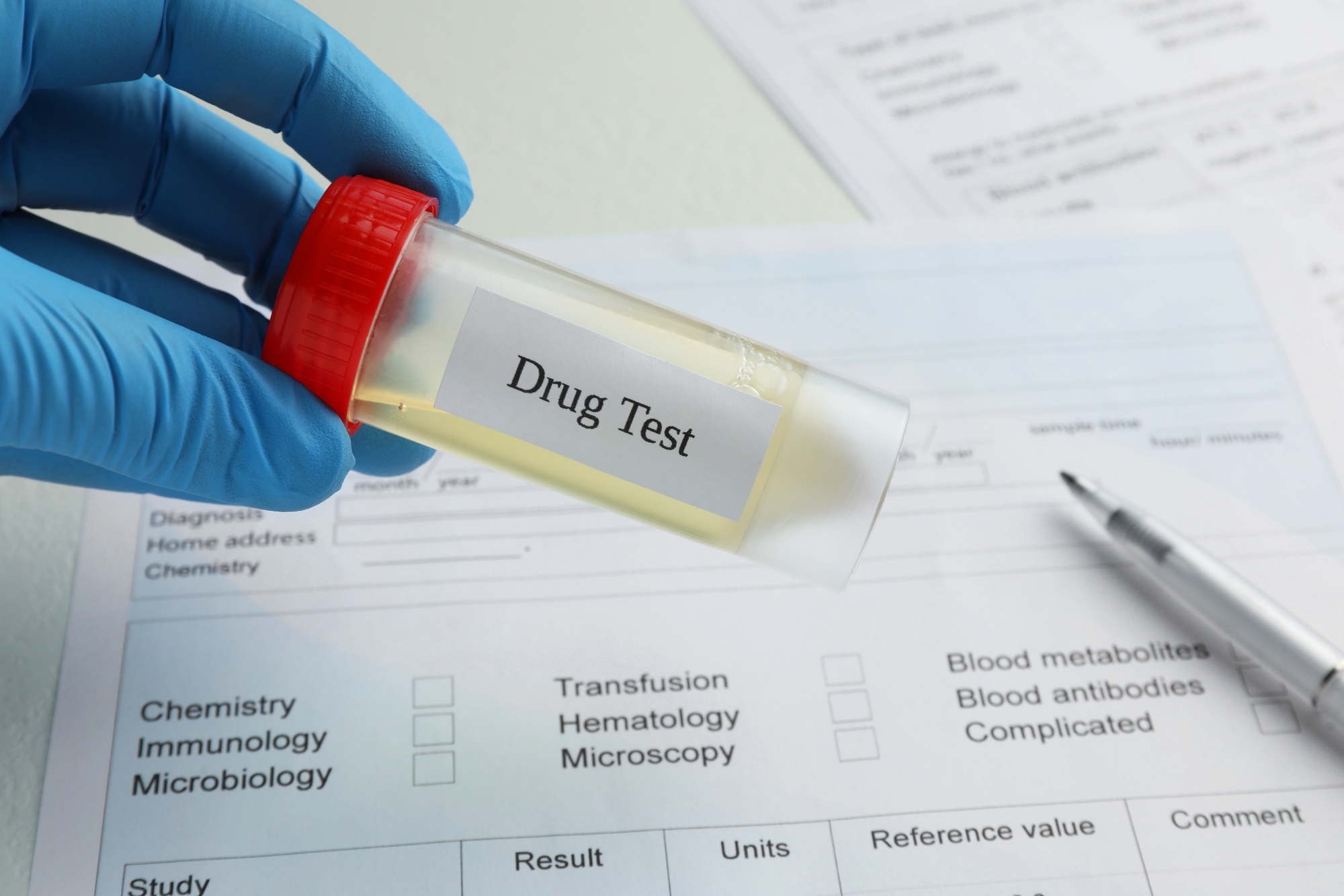 Drug Testing | San Jose, CA – CLEAR CHOICE SYSTEMS, INC.